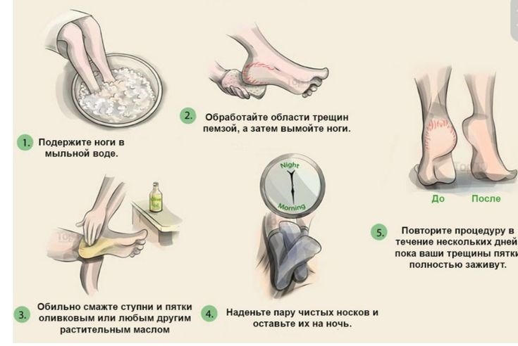 Можно ли курить Одноразку если она шипит после затяжки?